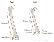 Growth plates - Adolescent injuries