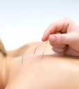 acupuncture offered at Dunsborough Physiotherapy Centre
