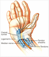 Carpal tunnel information - dunsborough physiotherapist helps