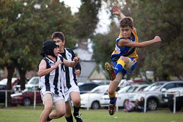 footy injuries in Dunsborough - physio info