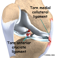 knee injuries seen - Dunsborough Physiotherapy Centre