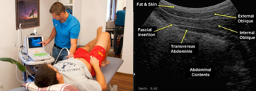 Real-Time Ultrasound available - Dunsborough Physio