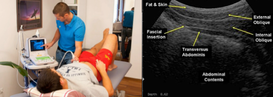 Real-time ultrasound at Dunsborough Physiotherapy Centre